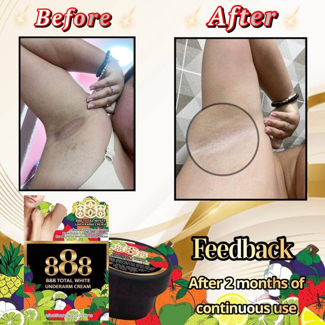 888 Total white underarm cream