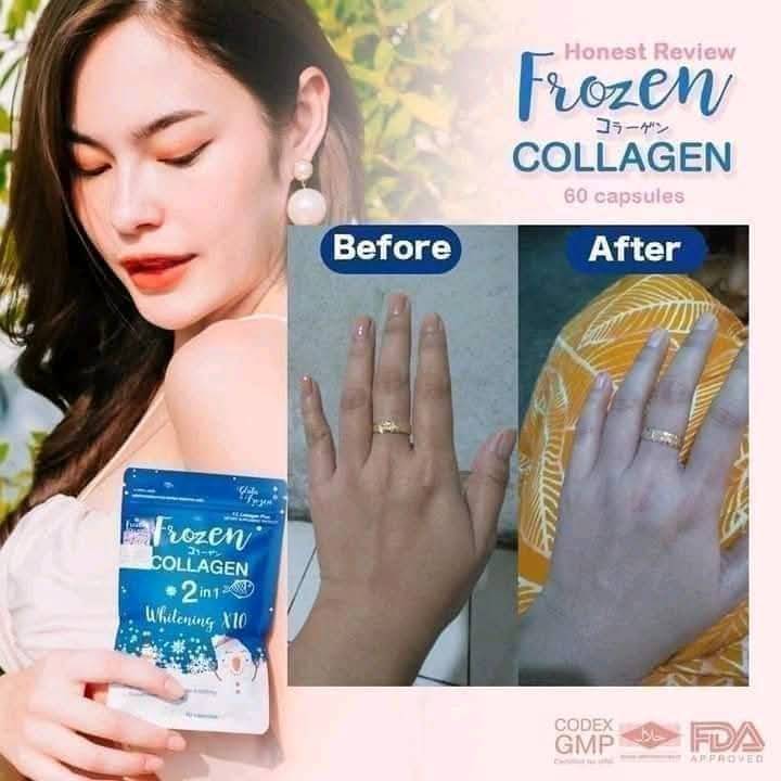 Frozen Collagen